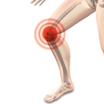 Arthrose: Ursachen, Symptome und was du sonst noch wissen solltest!